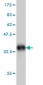 ITGB5 Antibody (monoclonal) (M01)