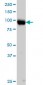 ITGB5 Antibody (monoclonal) (M01)