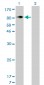 ITGB5 Antibody (monoclonal) (M01)