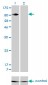 ITGB5 Antibody (monoclonal) (M01)