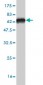 ITPK1 Antibody (monoclonal) (M01)