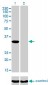 ITPK1 Antibody (monoclonal) (M01)