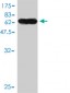 JAM2 Antibody (monoclonal) (M01)