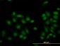 JARID1B Antibody (monoclonal) (M02)