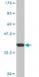 JARID1B Antibody (monoclonal) (M02)