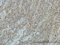 JUP Antibody (monoclonal) (M01)