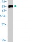 JUP Antibody (monoclonal) (M01)