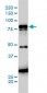 JUP Antibody (monoclonal) (M01)