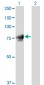 JUP Antibody (monoclonal) (M01)