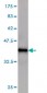 KAL1 Antibody (monoclonal) (M01)