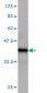 KAL1 Antibody (monoclonal) (M01)
