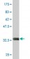 KCNIP2 Antibody (monoclonal) (M01)