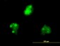 KHDRBS1 Antibody (monoclonal) (M03)