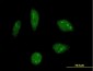 KHSRP Antibody (monoclonal) (M01)