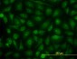 KIAA1967 Antibody (monoclonal) (M04)