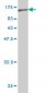 KIAA1967 Antibody (monoclonal) (M04)