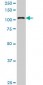 KIAA1967 Antibody (monoclonal) (M04)