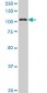 KIAA1967 Antibody (monoclonal) (M04)