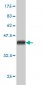 KIAA2002 Antibody (monoclonal) (M01)