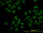 KIAA2002 Antibody (monoclonal) (M02)