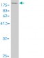 KIF2 Antibody (monoclonal) (M01)