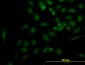 KIF2C Antibody (monoclonal) (M01)