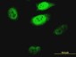 KLF1 Antibody (monoclonal) (M04)