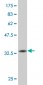 KLF1 Antibody (monoclonal) (M05)