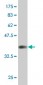 KLF11 Antibody (monoclonal) (M03)
