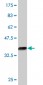 KLF12 Antibody (monoclonal) (M01)