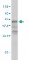 KLF6 Antibody (monoclonal) (M01)