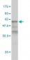 KLF6 Antibody (monoclonal) (M01)