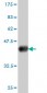 KNTC2 Antibody (monoclonal) (M01)