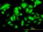 KRT17 Antibody (monoclonal) (M01)