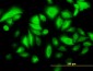 KRT17 Antibody (monoclonal) (M01)