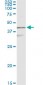 KRT17 Antibody (monoclonal) (M01)