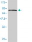 KRT17 Antibody (monoclonal) (M01)