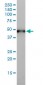 KRT17 Antibody (monoclonal) (M01)