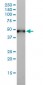 KRT17 Antibody (monoclonal) (M01)