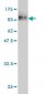 KRT17 Antibody (monoclonal) (M02)