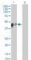 KRT17 Antibody (monoclonal) (M02)