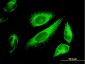 KRT18 Antibody (monoclonal) (M01)