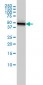 KRT18 Antibody (monoclonal) (M01)