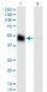 KRT18 Antibody (monoclonal) (M01)