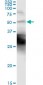 KRT18 Antibody (monoclonal) (M01)