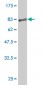 KRT18 Antibody (monoclonal) (M03)