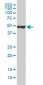 KRT20 Antibody (monoclonal) (M01)