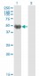 KRT20 Antibody (monoclonal) (M01)