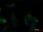 KRT20 Antibody (monoclonal) (M01)