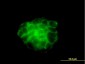 KRT4 Antibody (monoclonal) (M01)